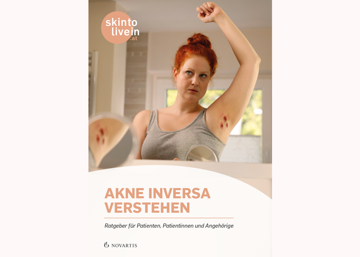 Teaser Broschüre Akne inversa verstehen