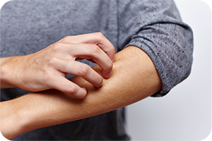 Nahaufnahme eines Unterarms, der mit der anderen Hand gekratzt wird. Die Person trägt ein graues Langarmshirt mit hochgekrempeltem Ärmel.